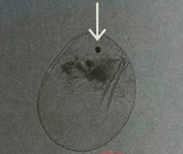야광충의 현미경 사진. 사진의 화살표는 야광충이 먹는 식물플랑크톤(왼쪽과 가운데가 각각 규조류)